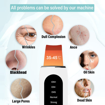 Ultrasonic Skin Scrubber 