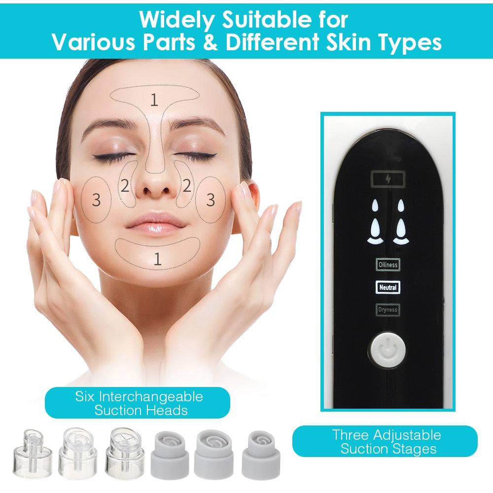 Blackhead Remover Pore Cleaner Vacuum Suction - Hollasoftshop